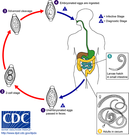Trichuris LifeCycle